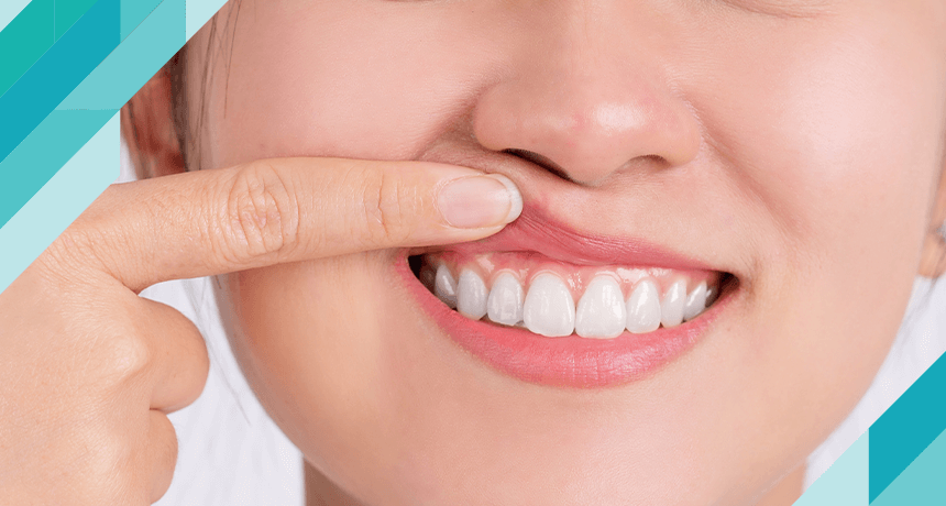 Dentofobi (Diş Hekimi Korkusu) Nedir?