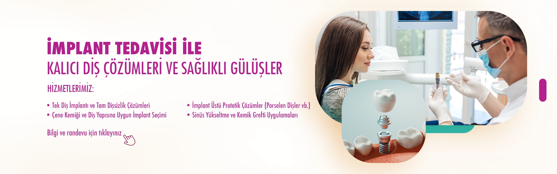 İmplant Tedavisi