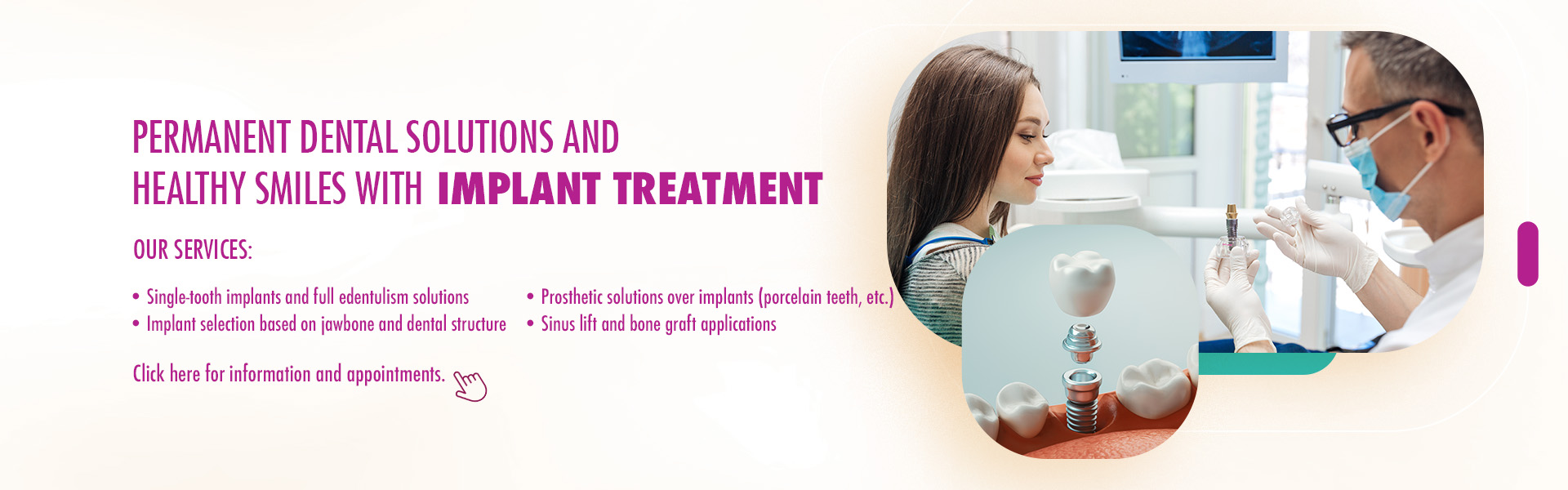 implant treatment