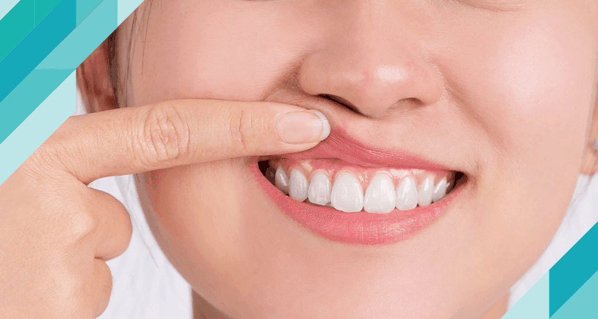 Dentofobi (Diş Hekimi Korkusu) Nedir?