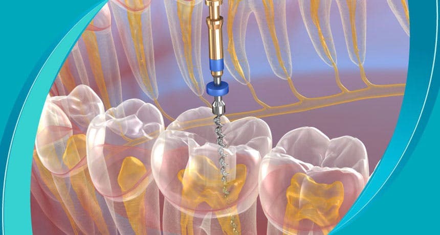 Endodontics  