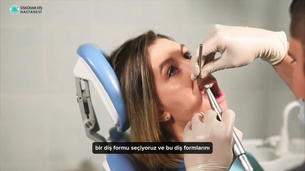 Gülüş Tasarımında 5 Önemli Adım-thumbnail