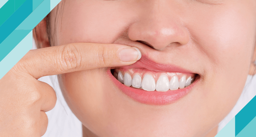 Что такое дентофобия (страх перед стоматологом)?  