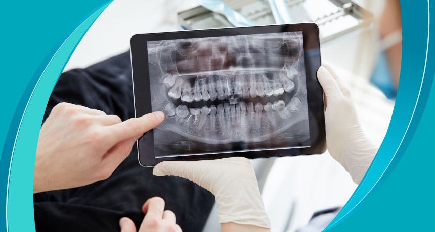What is Dental Tomography?