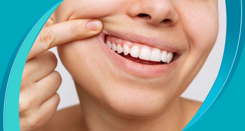 Как ухаживать за зубами и деснами?