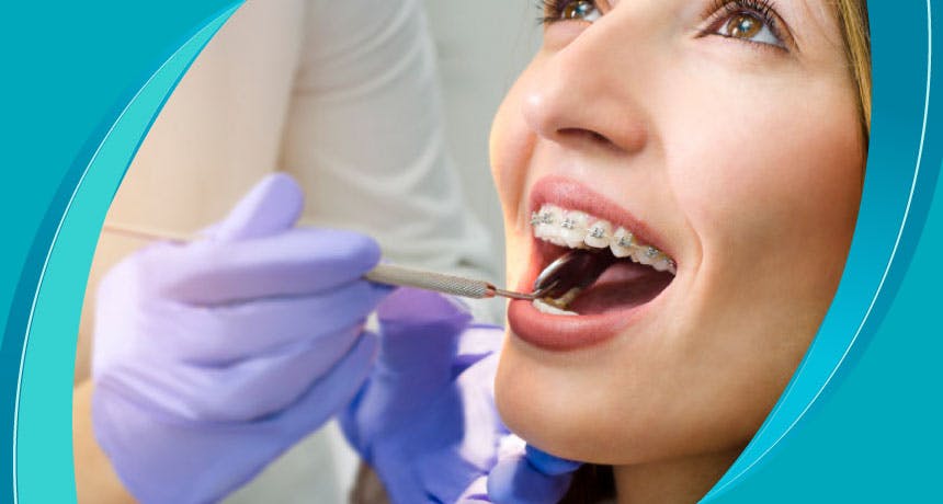 هل يؤثر تقويم الأسنان على الكلام؟  