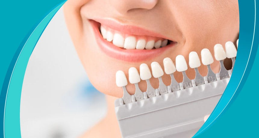 ما هي الأسنان التعويضية؟  