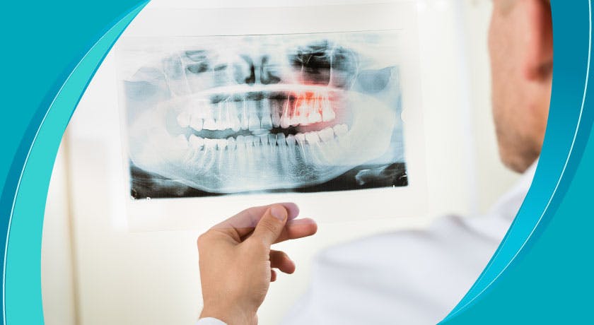 Радиология полости рта, зубов и челюстно-лицевой области